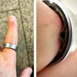 Smart rings på afveje: Hvorfor svulmer de op og eksploderer?