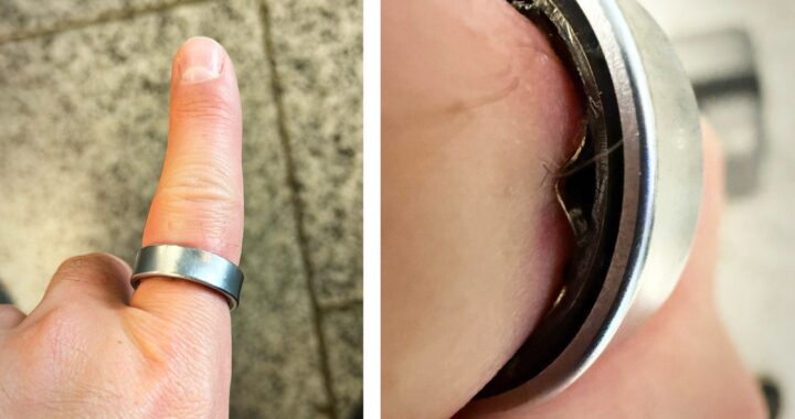 Smart rings på afveje: Hvorfor svulmer de op og eksploderer?